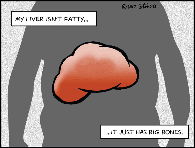 Fatty liver